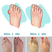 Last inn bildet i Galleri-visningsprogrammet, Comfortable Sandals With Thick Soles
